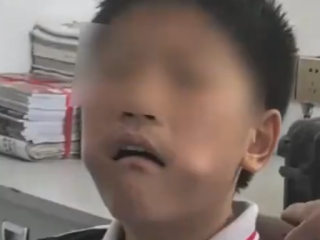男孩把三角尺塞进嘴中被卡 消防赶到后将尺子夹碎取出！