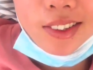 女子午休时开风扇 睡醒后面瘫 到底怎么回事？